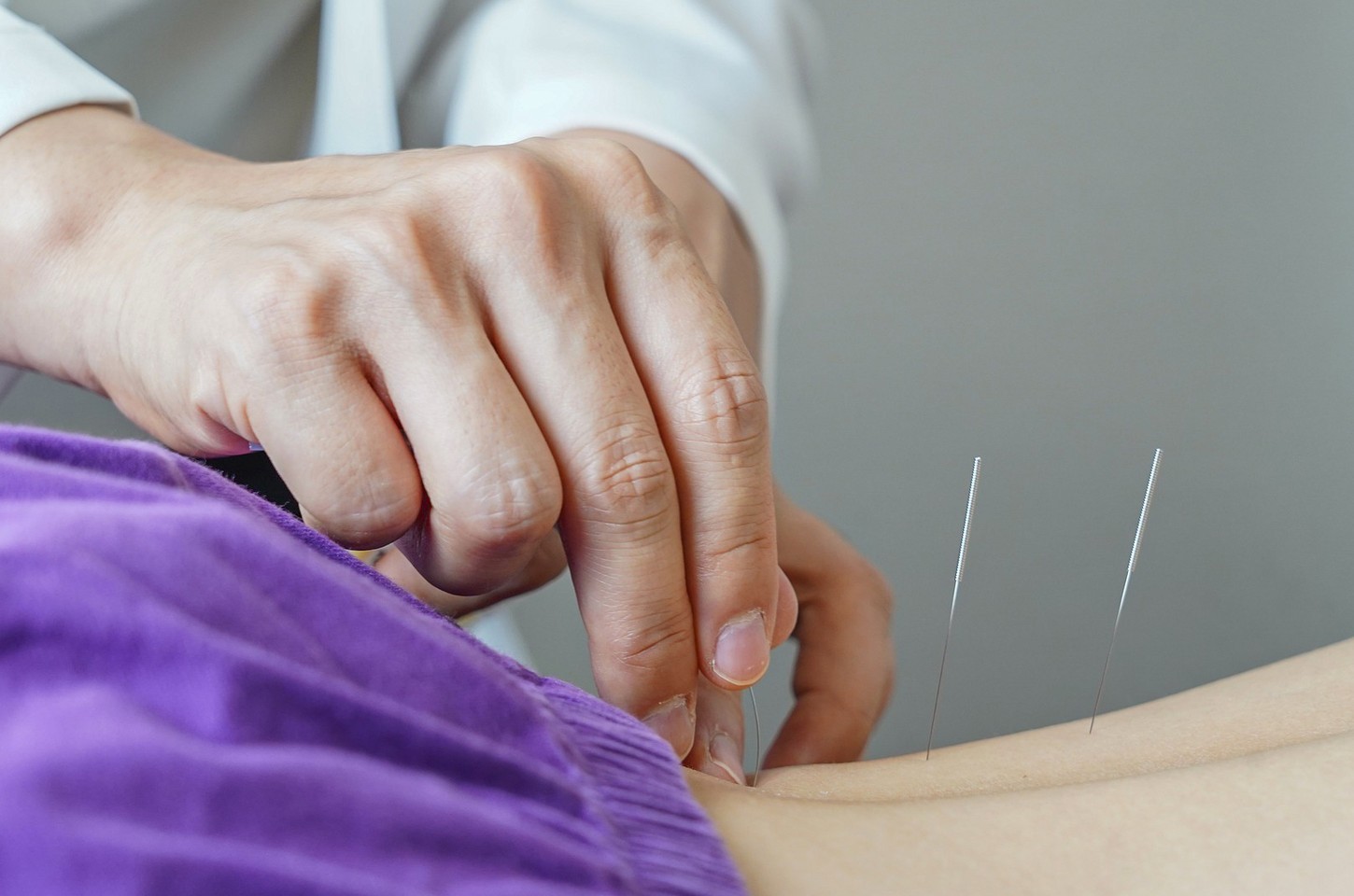 Acupuntura é regulamentada como profissão no Brasil