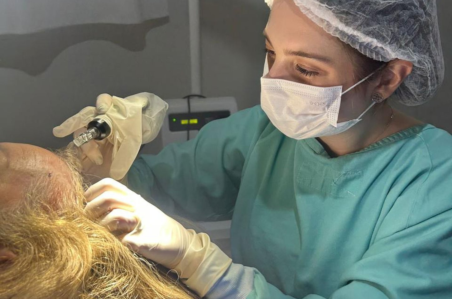 Alopecia: mais do que queda de cabelos, uma questão de saúde emocional
