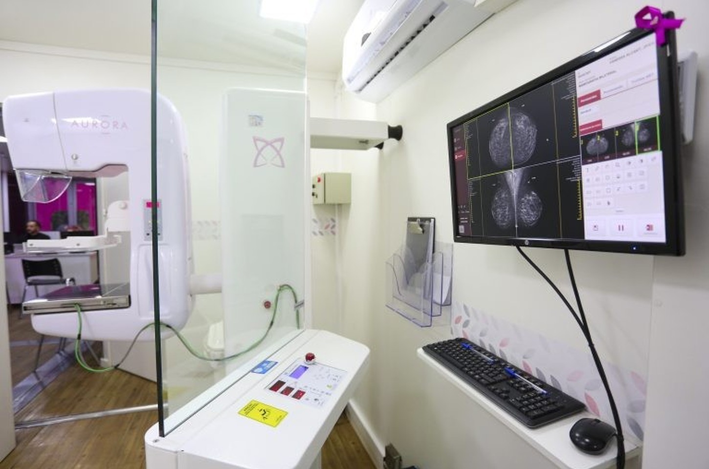 Carretas de Mamografia encerram mês da mulher com exames gratuitos em SP