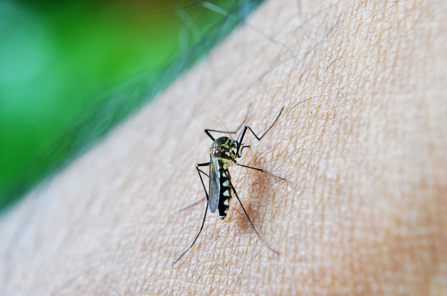Dengue aumenta risco de Síndrome de Guillain-Barré em até 30 vezes