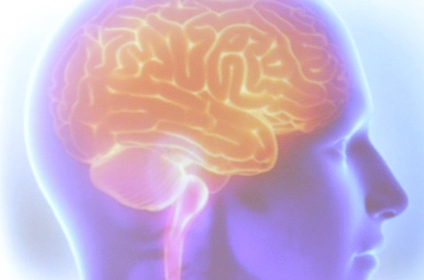 Estudo brasileiro investiga genética do AVC para medicina personalizada no SUS