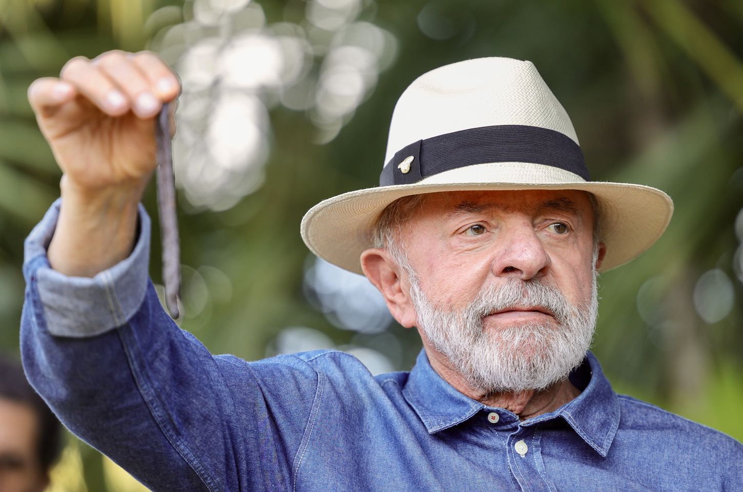 Lula passa por procedimento no couro cabeludo e no punho em SP