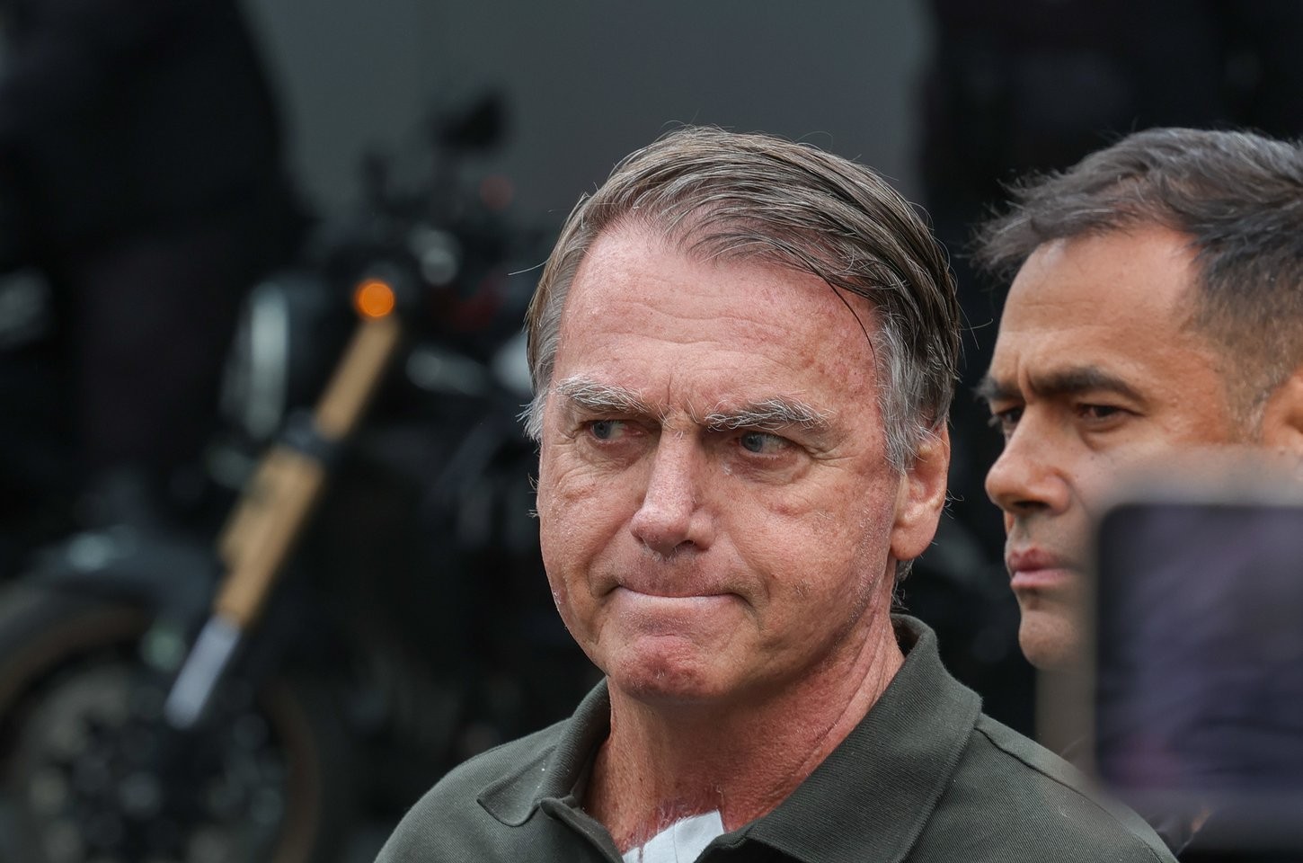 PGR é favorável a pedido de Bolsonaro para fazer cirurgia no ombro