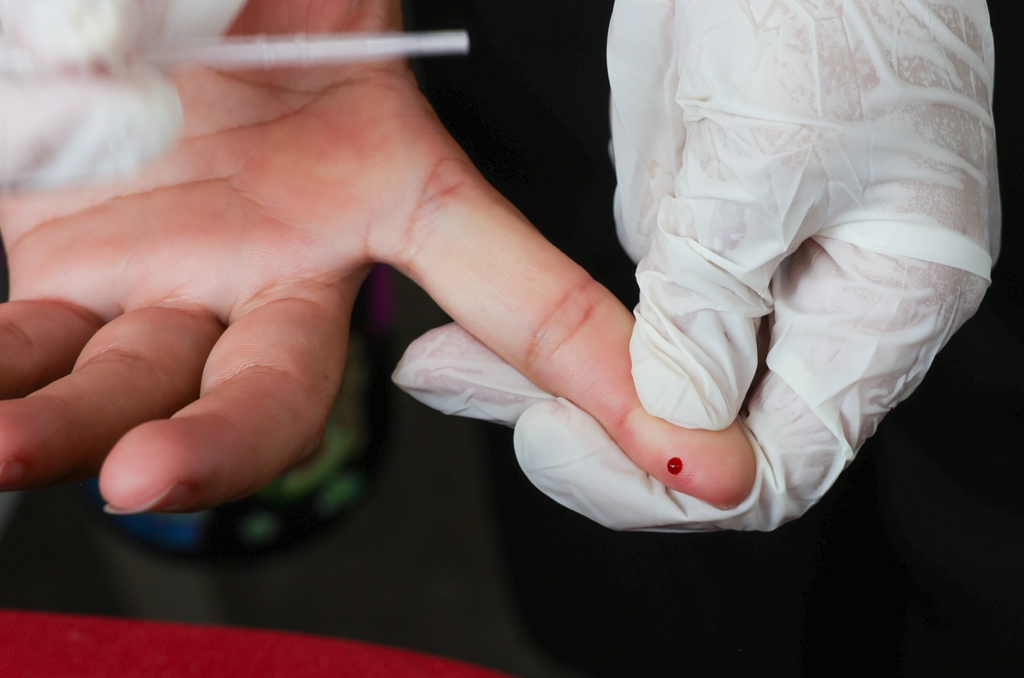 SUS incorpora teste rápido para diagnóstico precoce da dengue